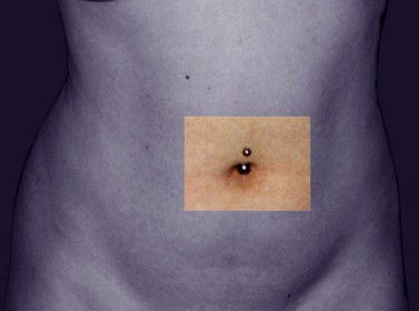 LES TROIS GRACES - 3